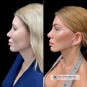 Фото после